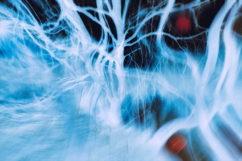 Medical imaging scans