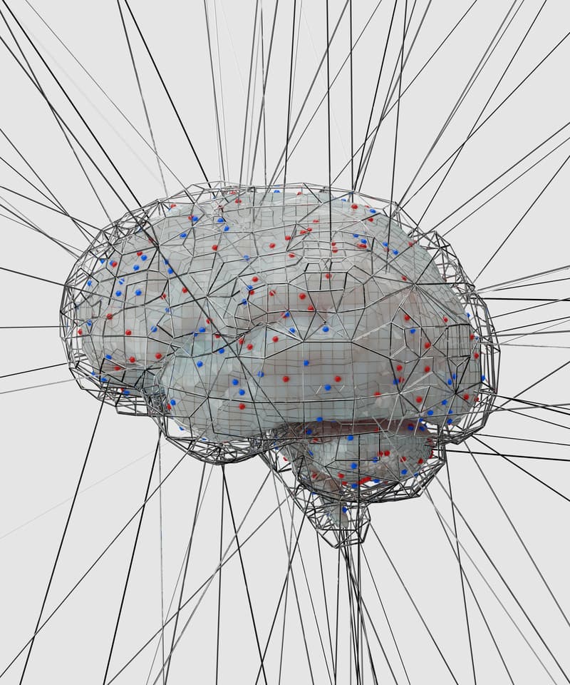 Neurovascular imaging